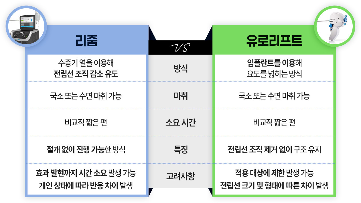 차이점